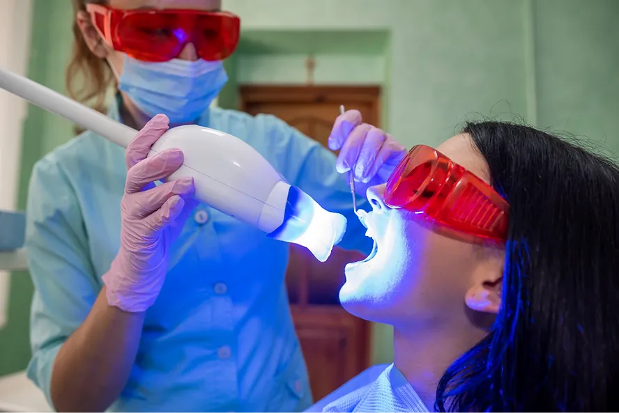 You are currently viewing Teeth Whitening at Home or at the Dentist: Which Option is Right for You?