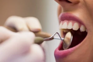 Dentist performing oral checkup with precision tools, offering safe and effective pain free dental treatment in Hyderabad for healthy, beautiful smiles