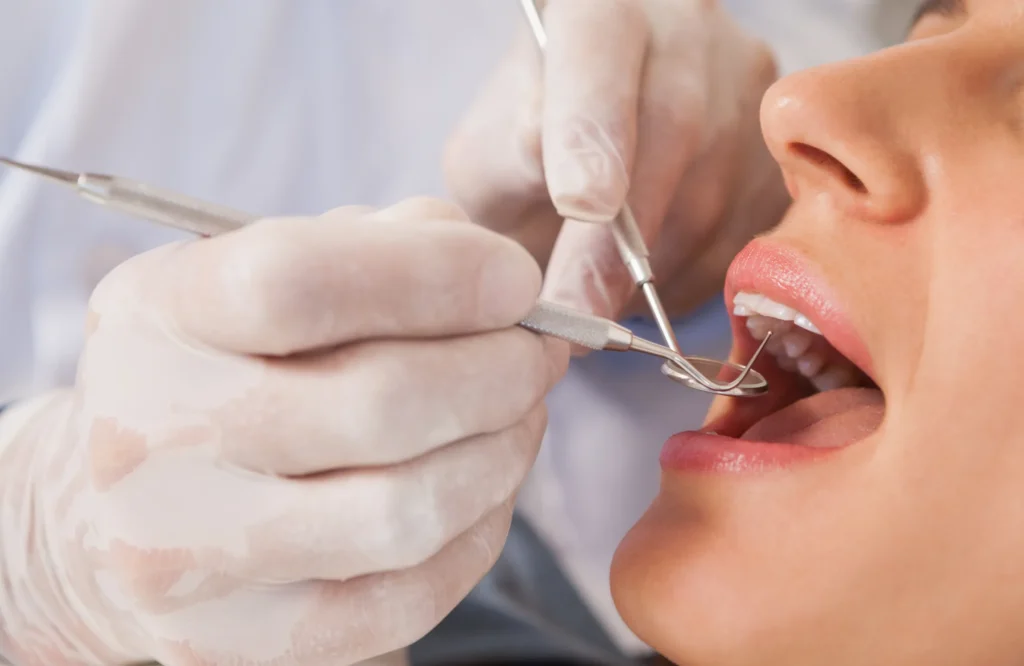 A dentist examining a patient’s teeth during a dental check-up, representing Best Dentist Near Me in Hyderabad – How to Choose the Right Dental Clinic for You.