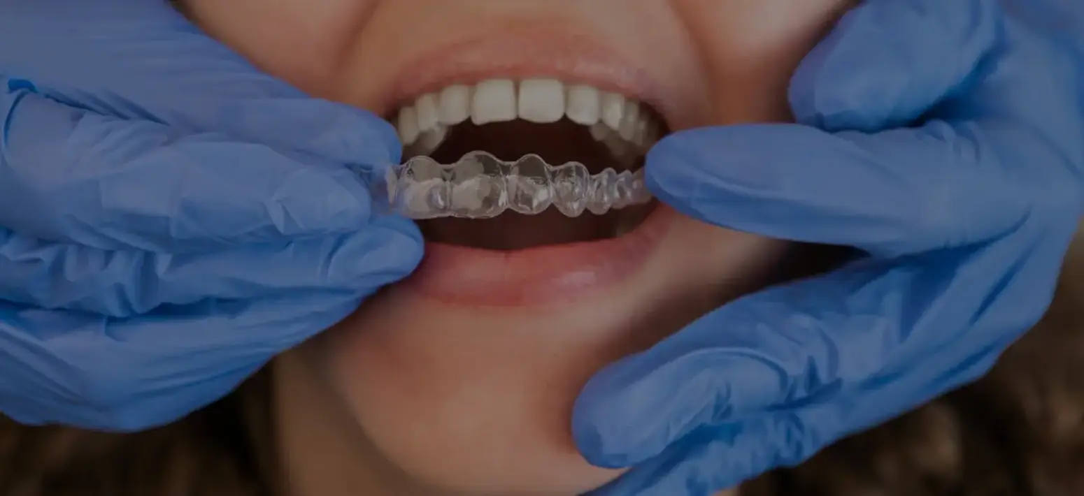 Invisalign Platinum Provider