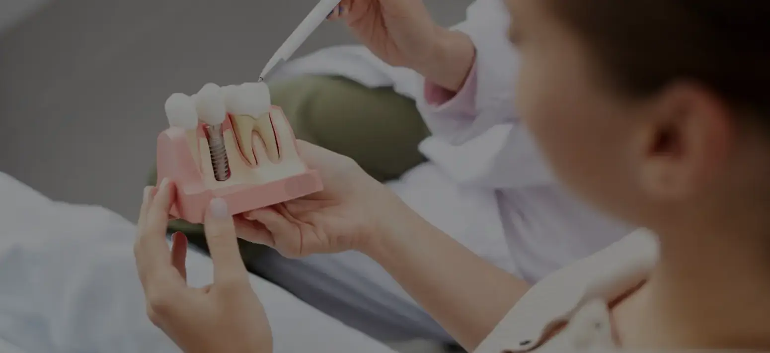 Implants Treatment