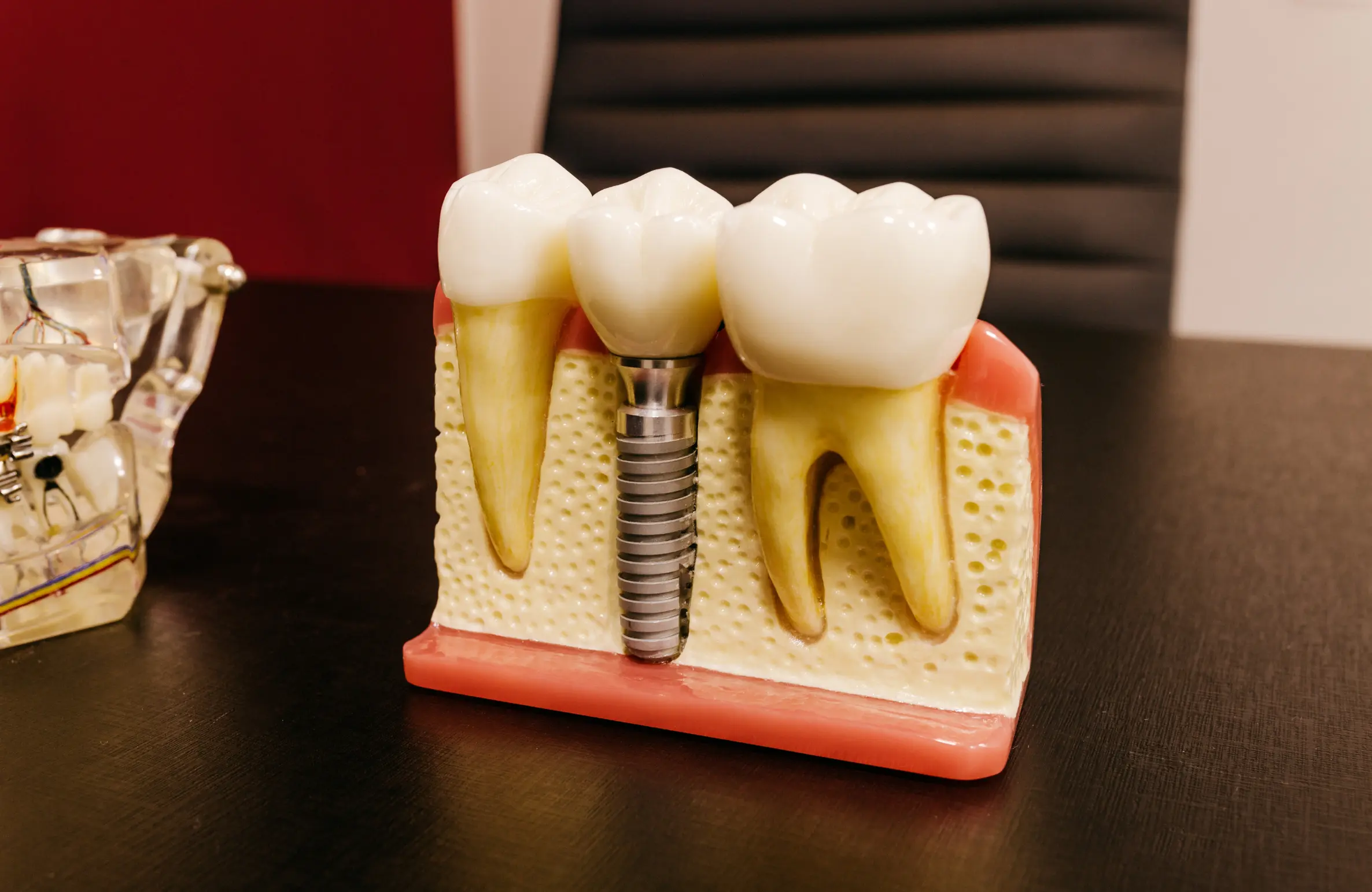 Dental Implants Explained: Benefits, Procedure, Cost, and Aftercare in Kokapet